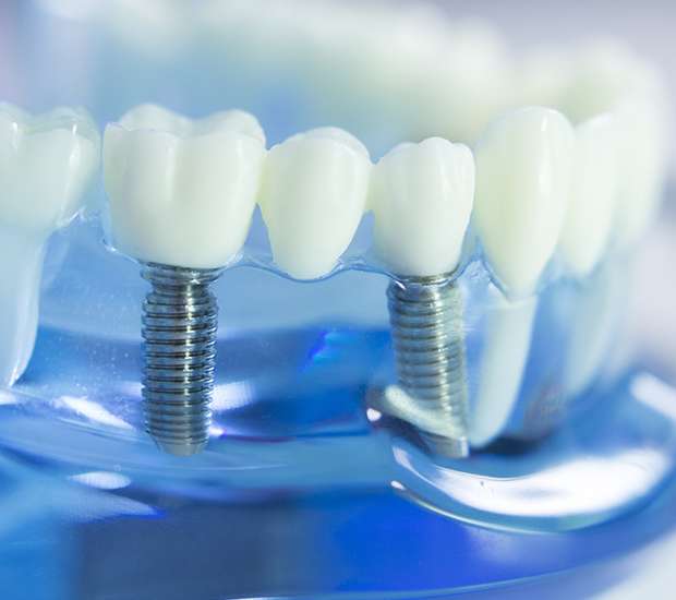 Bloomfield Dental Prosthetics