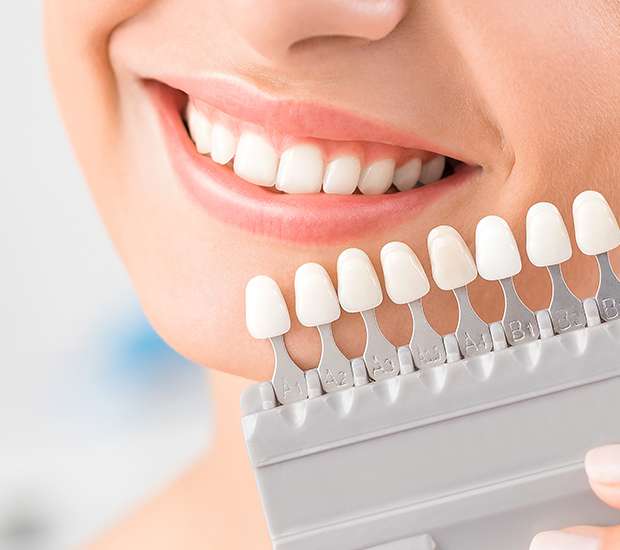 Bloomfield Veneers
