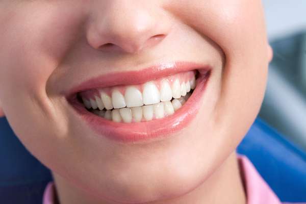A General Dentist Discusses the Benefits of Tooth Straightening from Creating Smiles Family Dental PC in Bloomfield, NJ