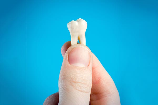 A General Dentist Helps You Decide Whether To Pull or Save a Tooth from Creating Smiles Family Dental PC in Bloomfield, NJ