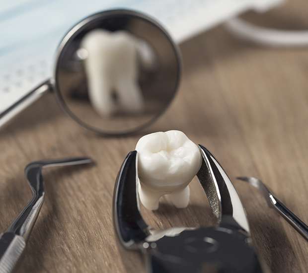 Bloomfield When Is a Tooth Extraction Necessary